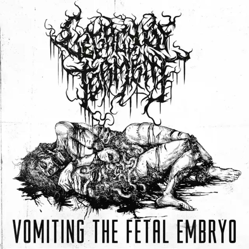 Vomiting the Fetal Embryo