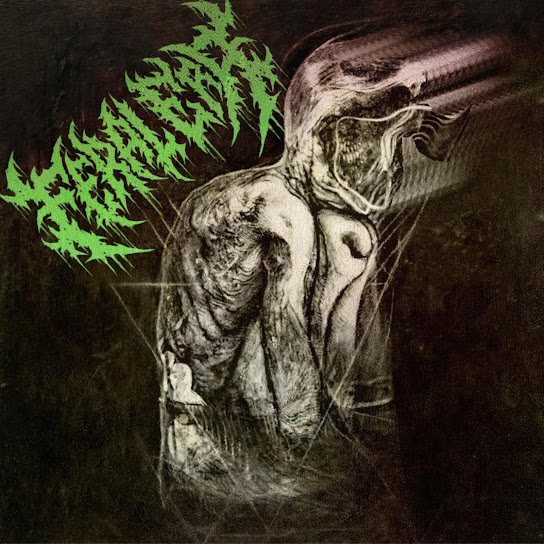 Fistula