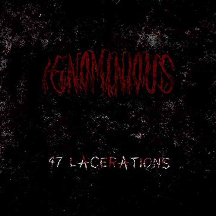 47 Lacerations