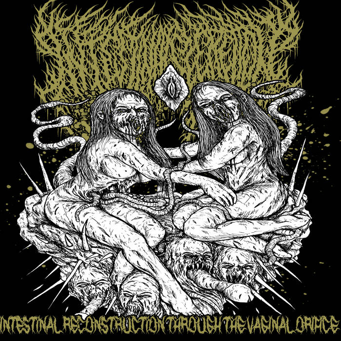 Intestinal Reconstruction Through the Vaginal Orifice
