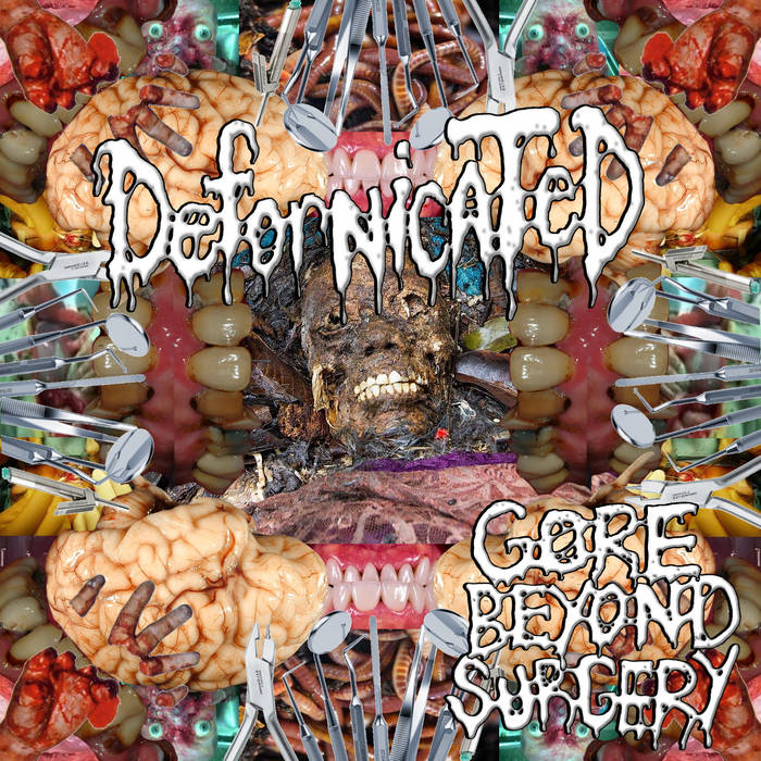 Gore Beyond Surgery