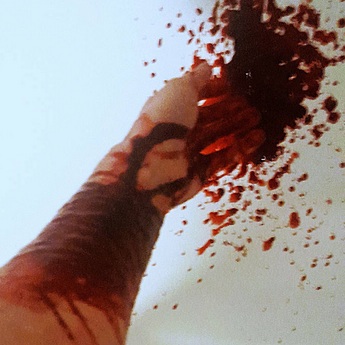 Almost Dead