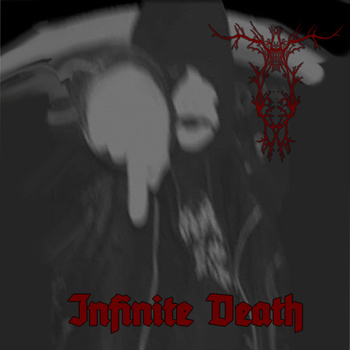 Infinite Death