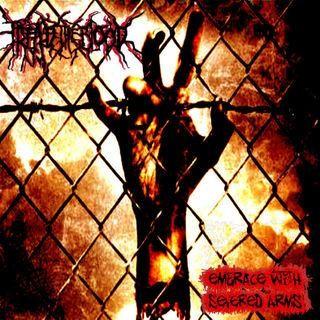 Embrace with Severed Arms